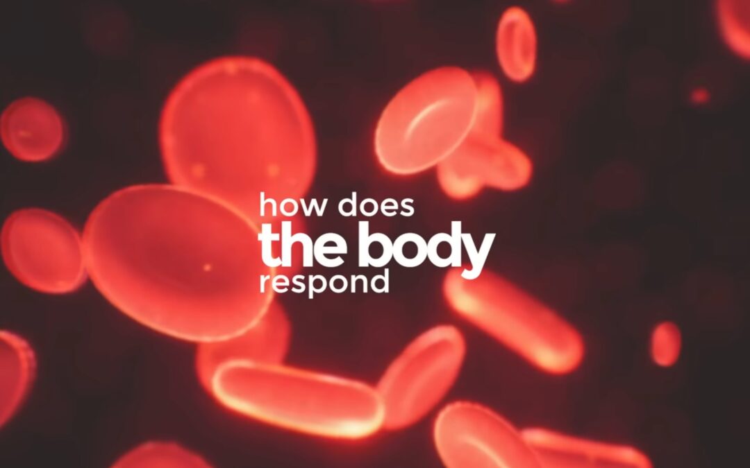 Sepsis & septic shock (no)